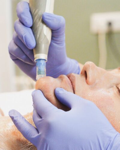 dermapen4